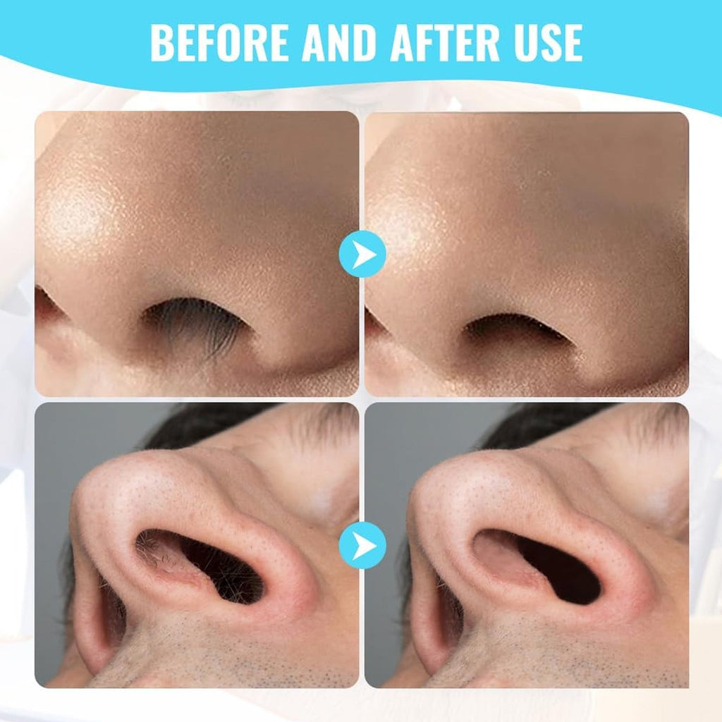 Nose Hair Trimmer – Painless 3-in-1 Grooming Kit | PureBeard